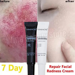 Facial Redness Repair Cream Improve Sensitive Skin Dryness Hydrating Sooth Lotion Removal Rosacea Day Night Korean Cosmetics