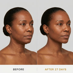 JAWLIFT Mask | Sculpting Jawline Enhancer, Second-Skin Fit