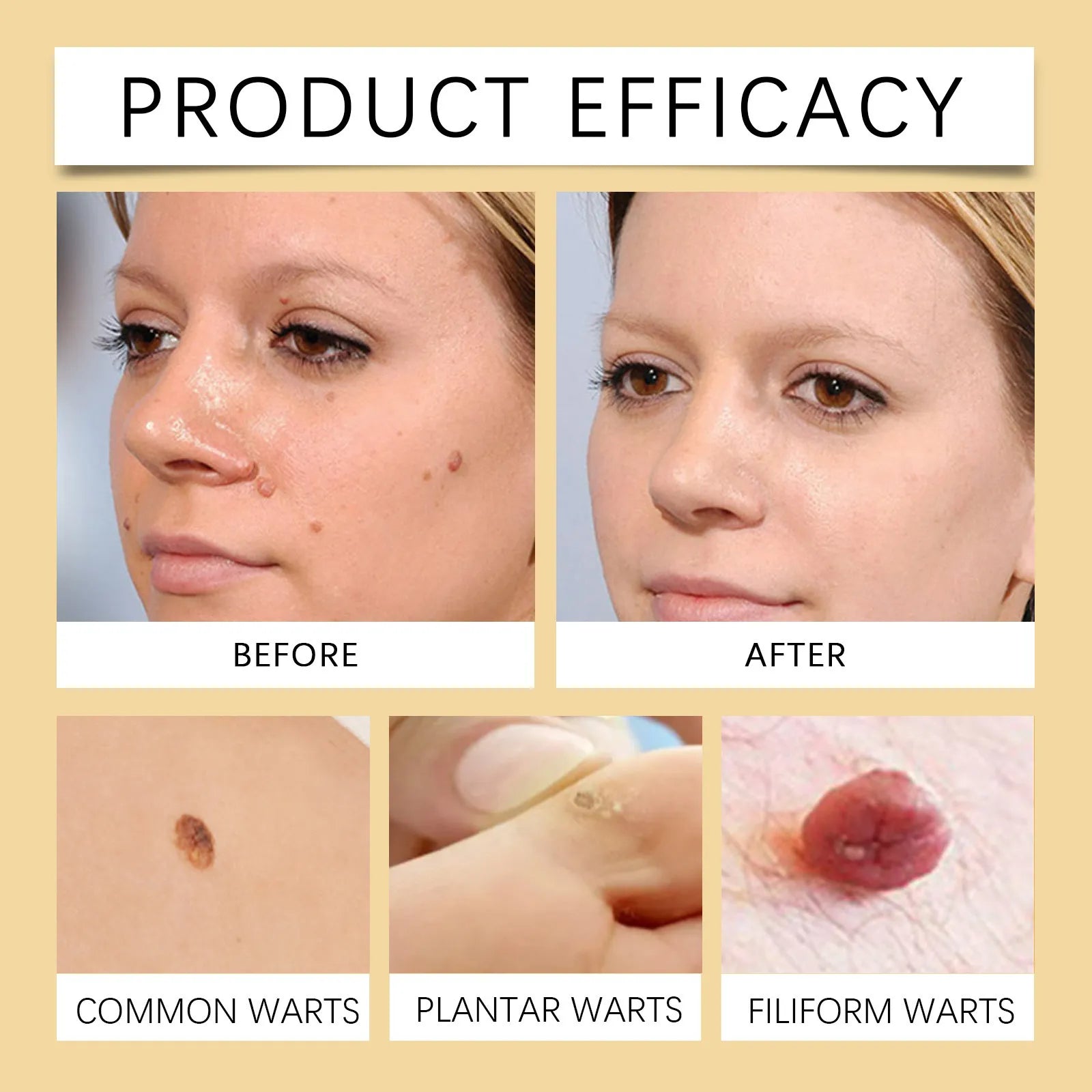 BeeVenom™ ClearSkin - Fast-Acting Skin Tag & Wart Refining Cream