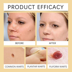 BeeVenom™ ClearSkin - Fast-Acting Skin Tag & Wart Refining Cream