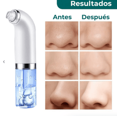 LumiPure™ — Unlock irresistibly smooth, clear skin that turns heads everywhere