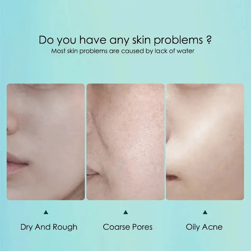 Hyaluronic Acid Hydrating Facial Sheet Masks, 10-Pack
