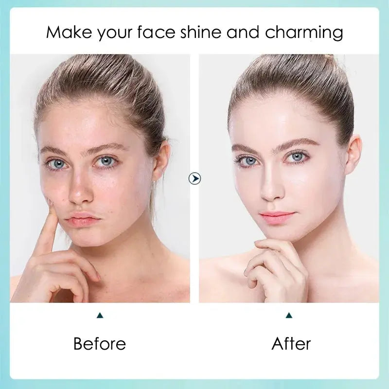 Hyaluronic Acid Hydrating Facial Sheet Masks, 10-Pack