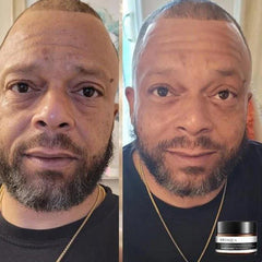 1+1 FREE | EverYouth™ Unlock the Fountain of Youth Today! 