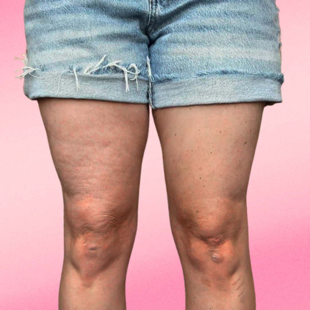 Berosely Instant Lift Patches 