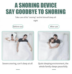 Anti-Snoring Device | 4 PCS 