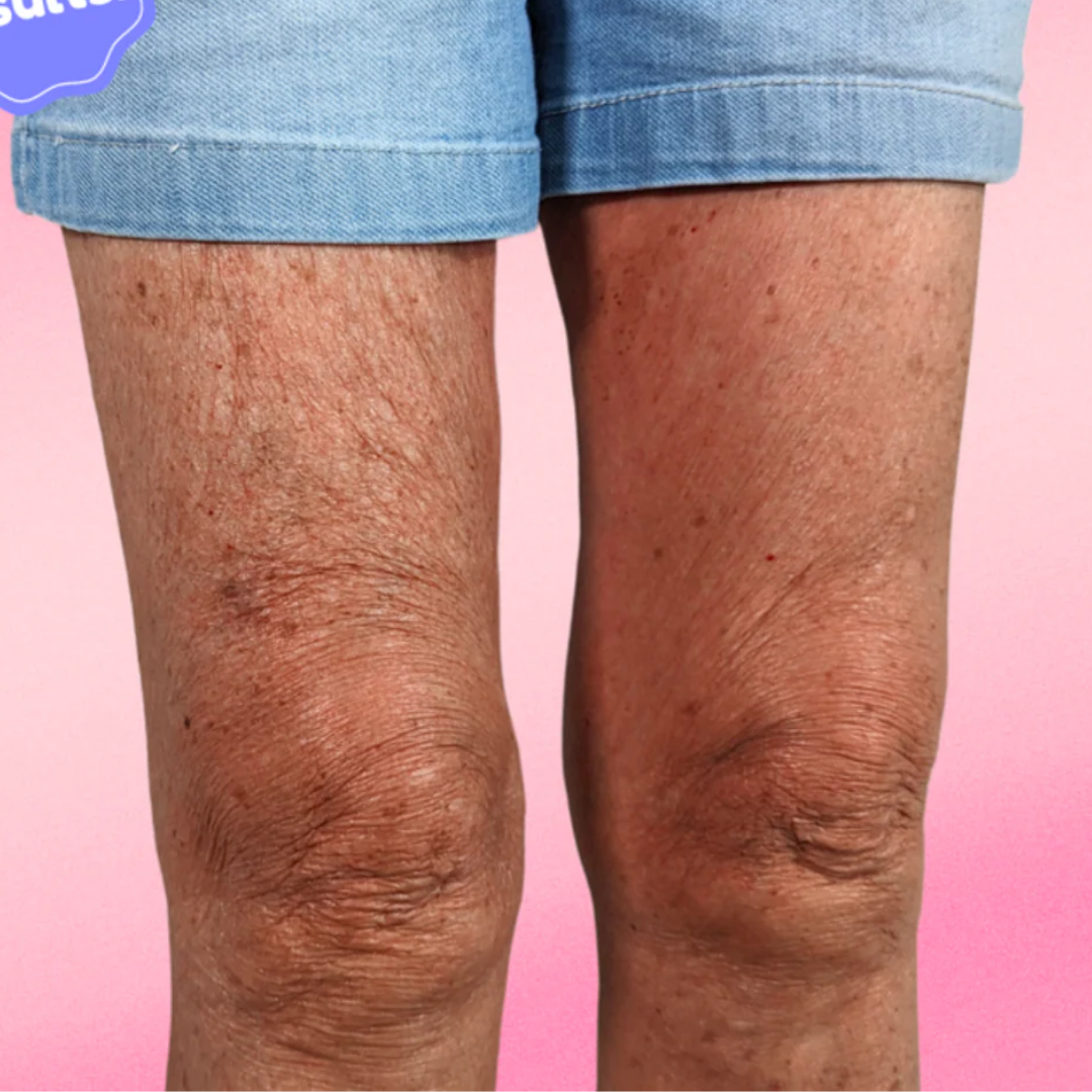 Berosely Instant Lift Patches 