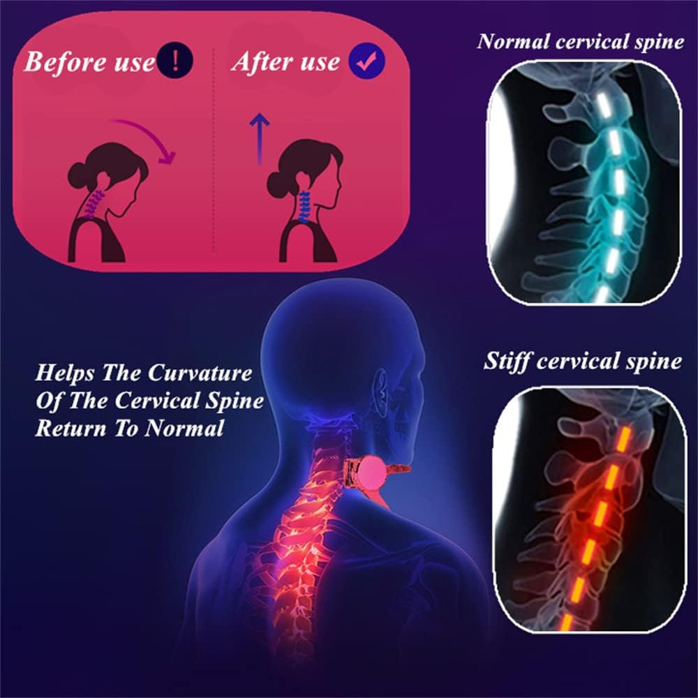 Cervical Spine Fixator – Adjustable Stretch Neck Protector for Ultimate Comfort and Support 