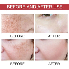 Achieve Radiant, Even-Toned Skin with Every Drop 