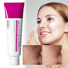 Aura Radiance Cream | Fast Dark Spot Remover, Lightweight, Hydrating 