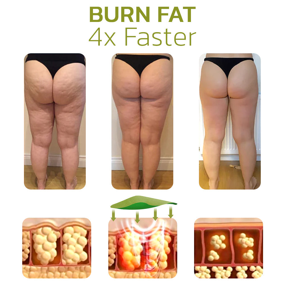 CelluSmooth™ Huidverbeterende en Cellulite Verminderende Oplossing 