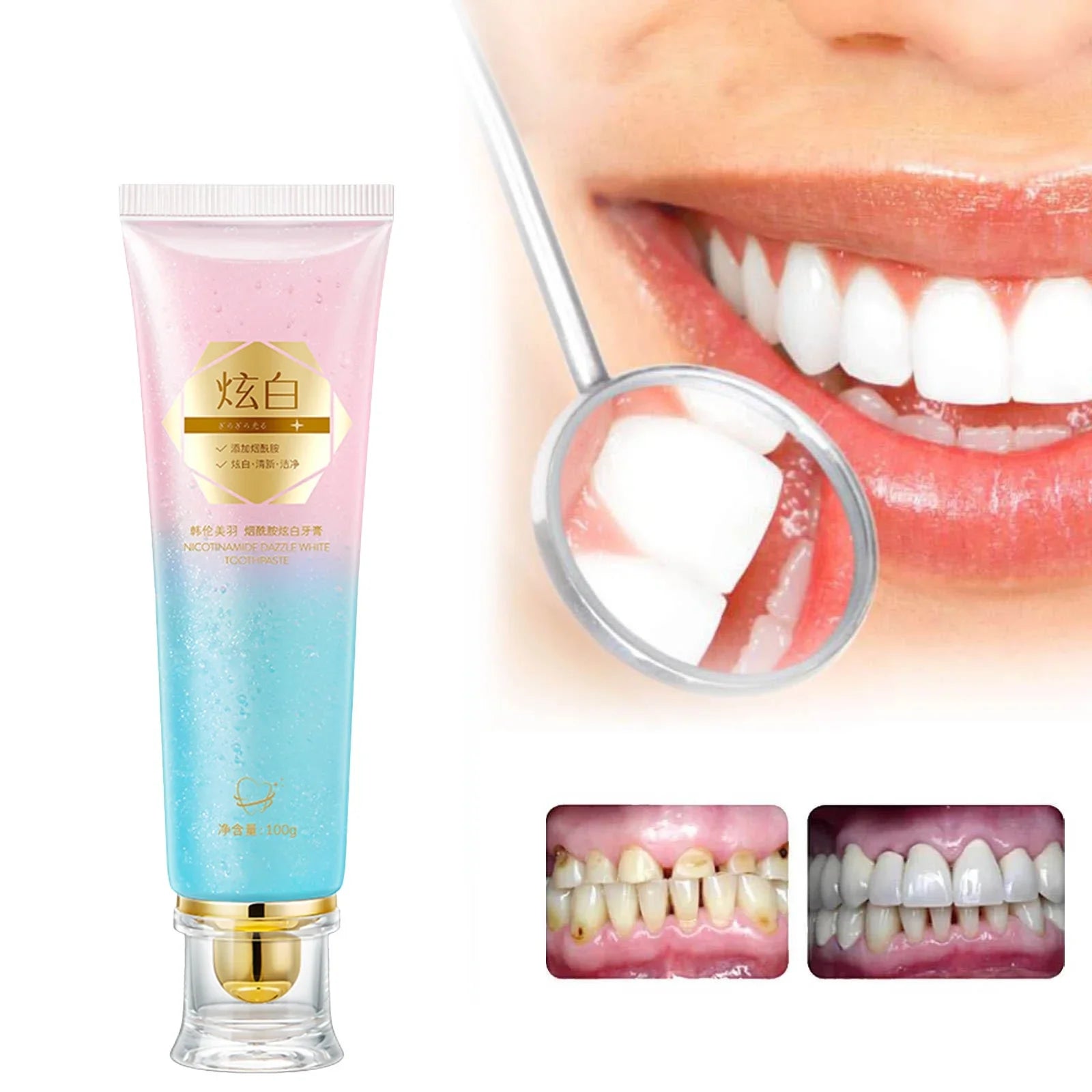 BrightWhite Niacin | Whiten and Protect Your Smile with Niacinamide-Powered Toothpaste 
