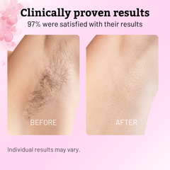 Cypress Hair Reduction Oil | Natural Blend for Smooth Skin 