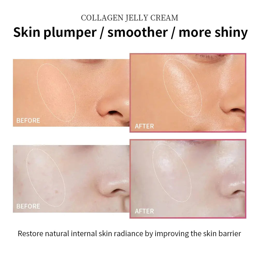 Collagen Jelly Cream - Deep Hydrating & Firming Anti-Aging Moisturizer
