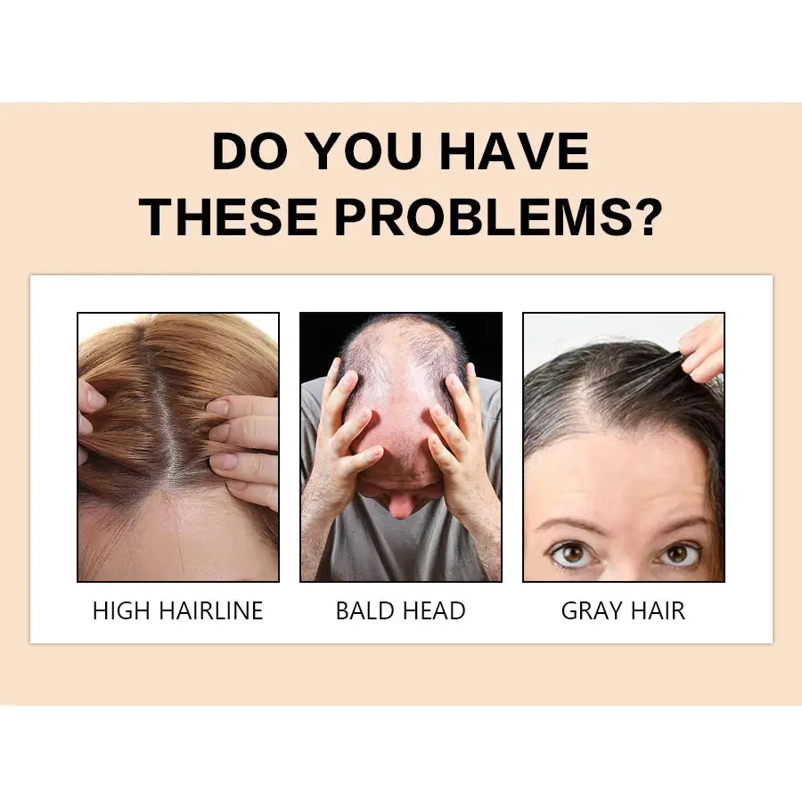 GOIPLE Hair Building Fiber Powder – Natural Thickening, Waterproof, Long Lasting