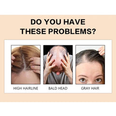 GOIPLE Professional Hair Building Fibers Powder Waterproof Long Lasting Unisex Natural Thickening Hair Anti-loss Fiber Products