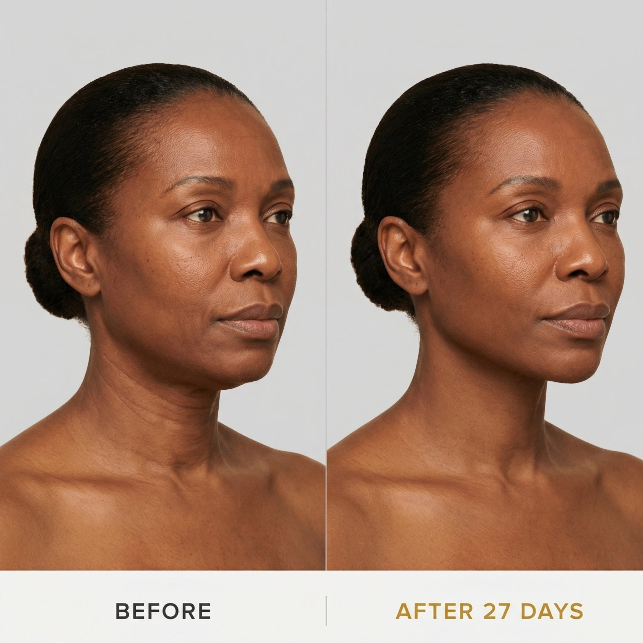 JAWLIFT Mask | Sculpting Jawline Enhancer, Second-Skin Fit 