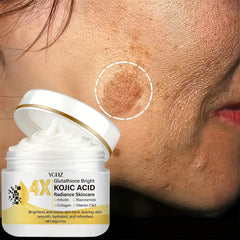 Kojic Acid Face Cream, Evens Out Skin Tone, Eliminates Dark Spots and Dullness - Non-Greasy, Suitable for Both Men and Women - Whitening and Moisturizing Cream, for Day and Night Use - 60g