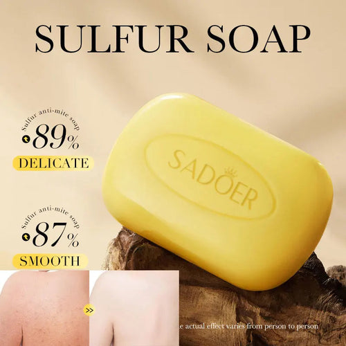 1Box Sulfur Anti Mite Soap Cleansing The Body Handmade Soap Turmeric Acid Kojico Foam Moisturize Control Oil and Prevent Dry dylinoshop
