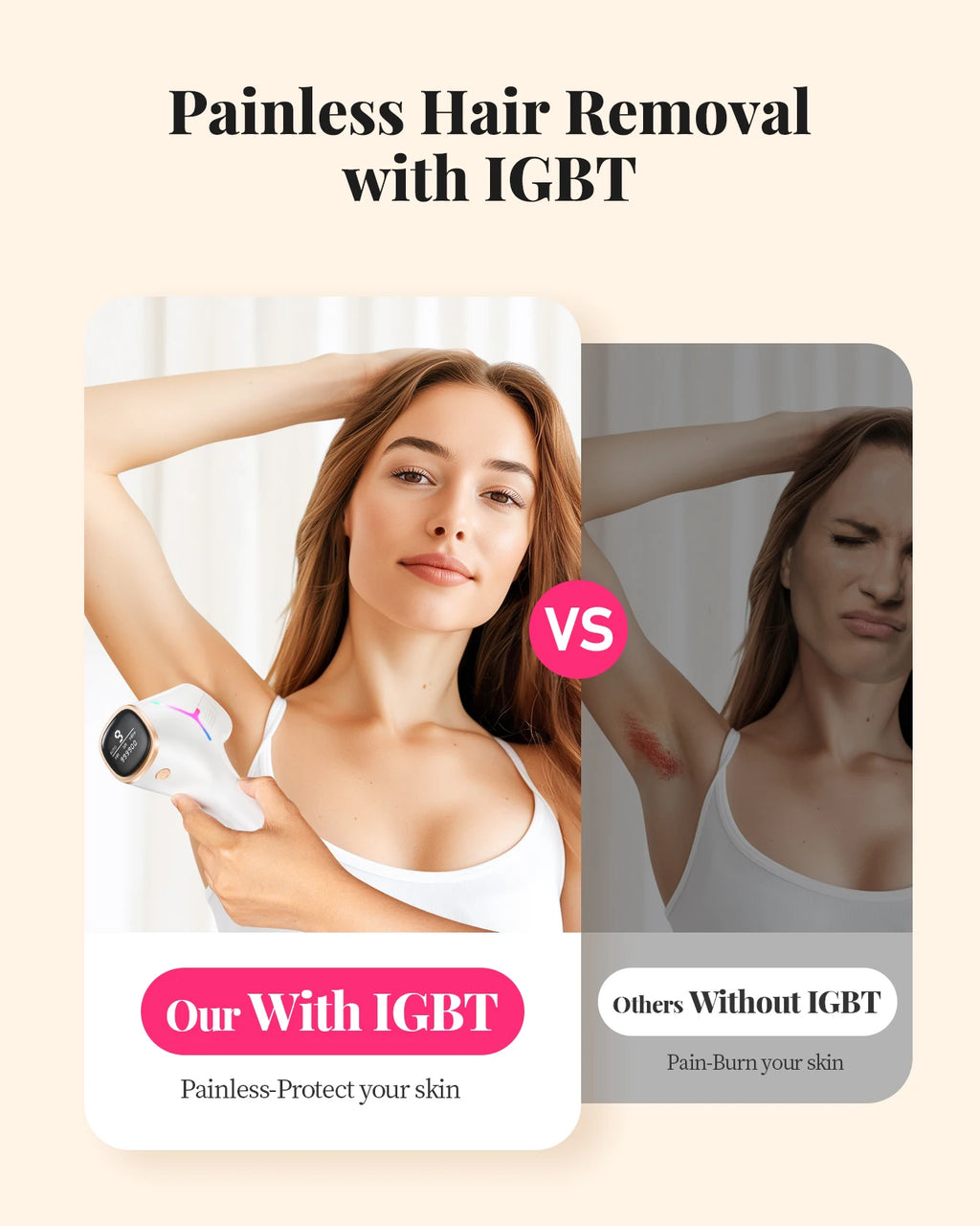 IPL Hair Removal Device for Body, Bikini & Face – 990,000 Flashes