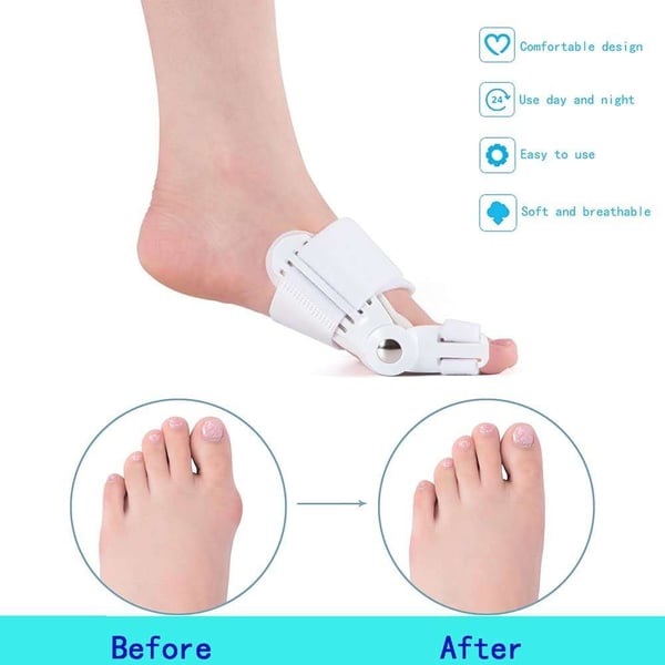 BalanceEase Bunion Corrector | Adjustable Toe Alignment Support 