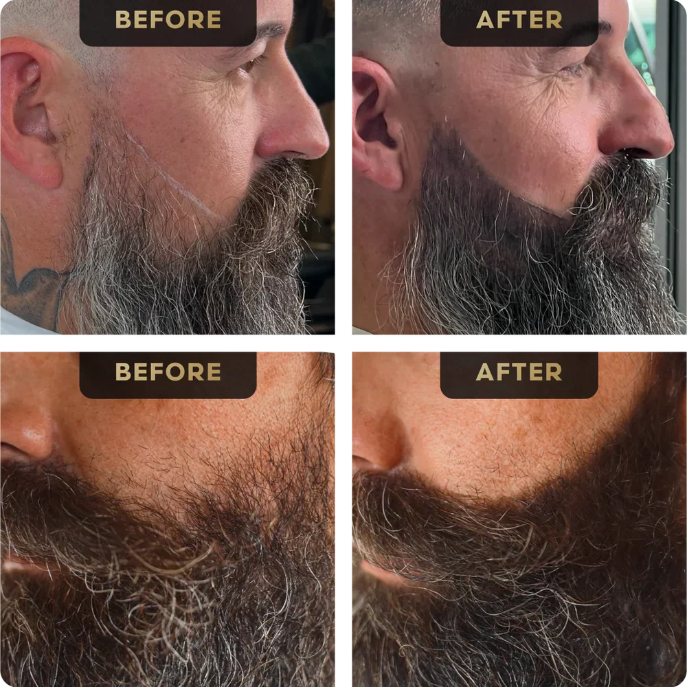 BeardFix™ — Fill patchy spots fast with our sweatproof precision pen 