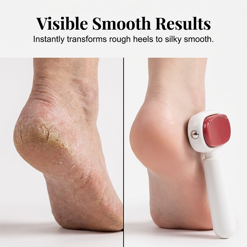 DailySmooth Stainless Callus File | Two-Surface Foot Care Tool 
