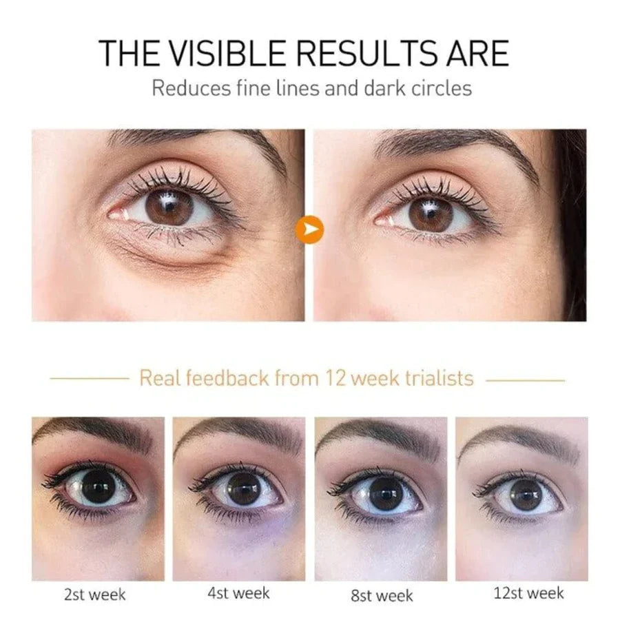Anti-aging & wrinkle-removing eye cream 