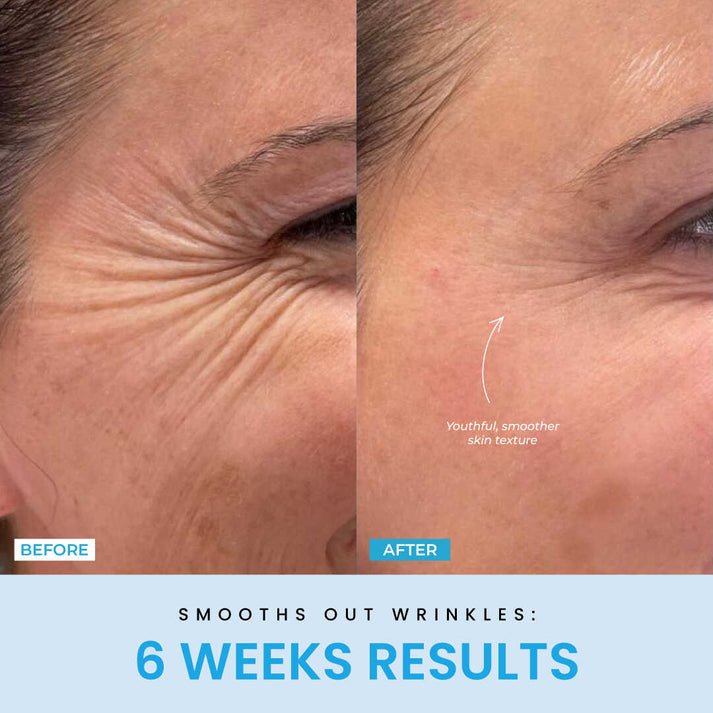 FaceVolt™ — Reclaim Your Youthful Glow and Sculpted Jawline in Minutes 