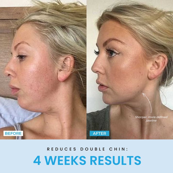 FaceVolt™ — Reclaim Your Youthful Glow and Sculpted Jawline in Minutes 