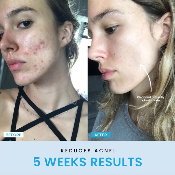 FaceVolt™ — Reclaim Your Youthful Glow and Sculpted Jawline in Minutes 