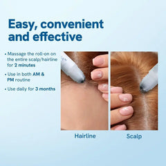 Felicity Hair Growth Serum | Powerful Follicle Activator, Precision Roller 