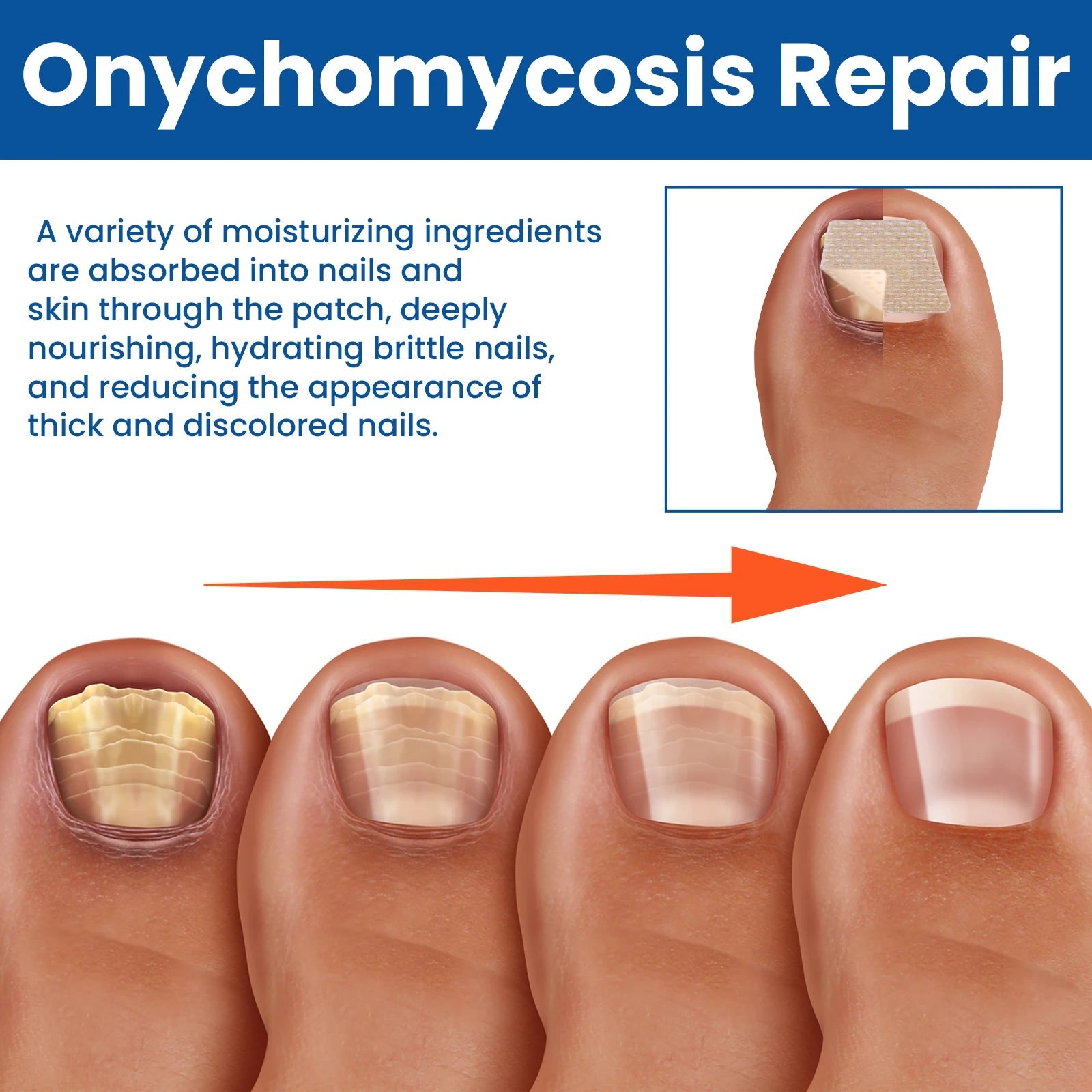 Fungal Nail Restoration Patches 60pcs 