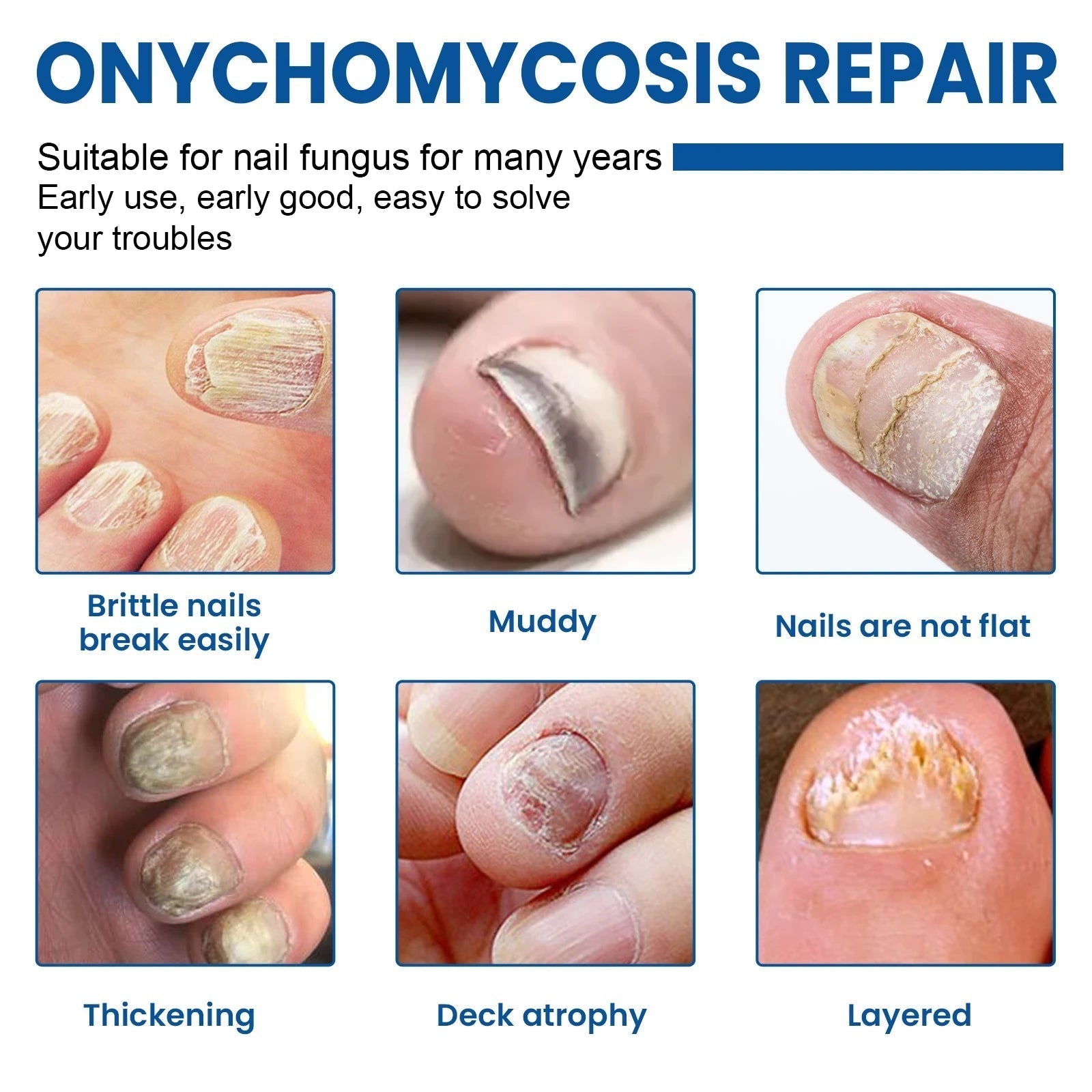 Fungal Nail Restoration Patches 60pcs 