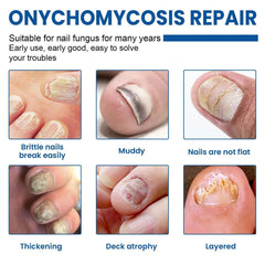 Fungal Nail Restoration Patches 60pcs 