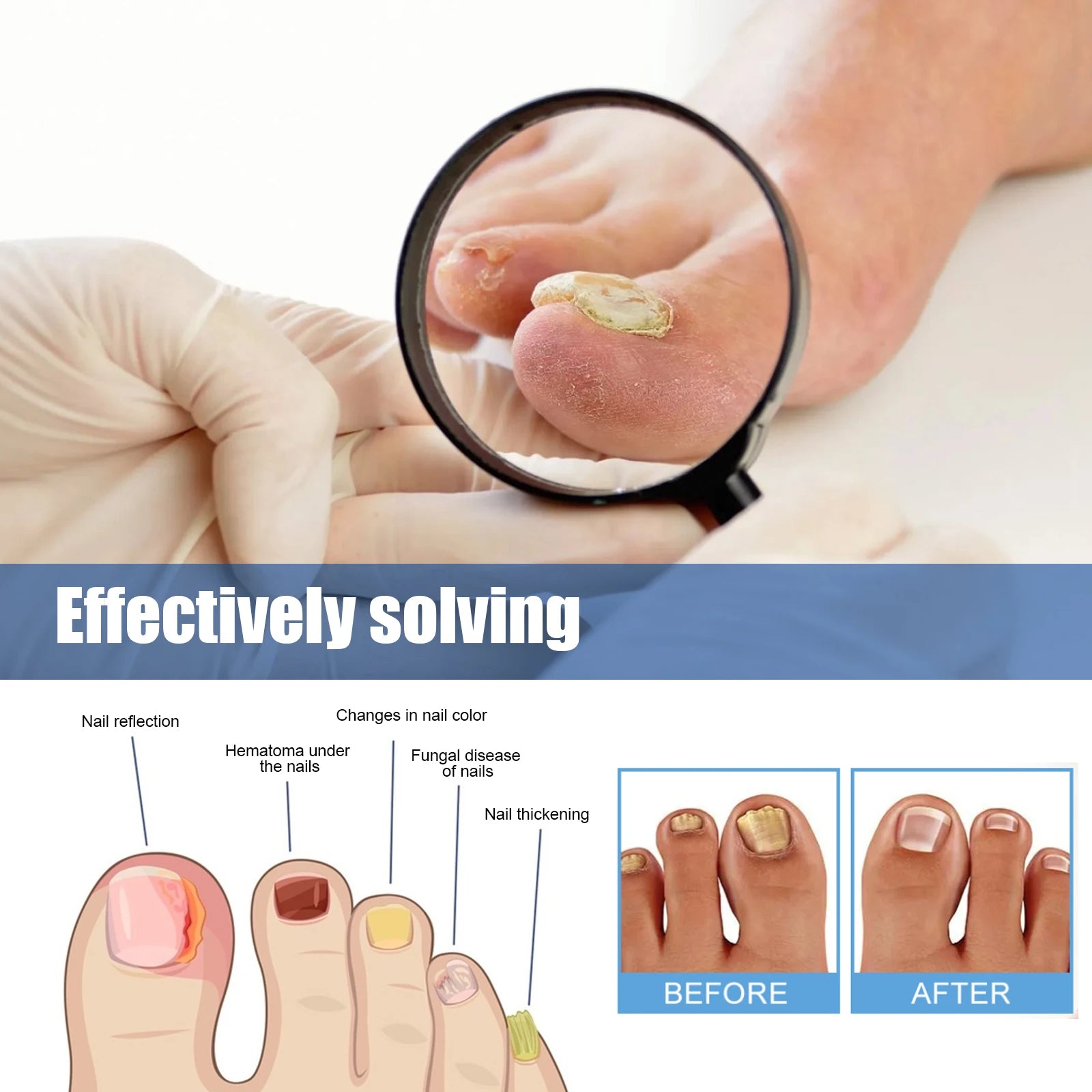 Fungal Nail Restoration Patches 60pcs 