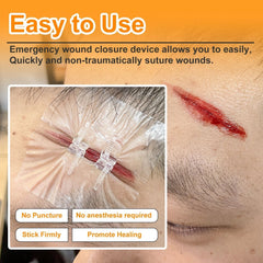 2PCS Advanced Wound Closure Kit 