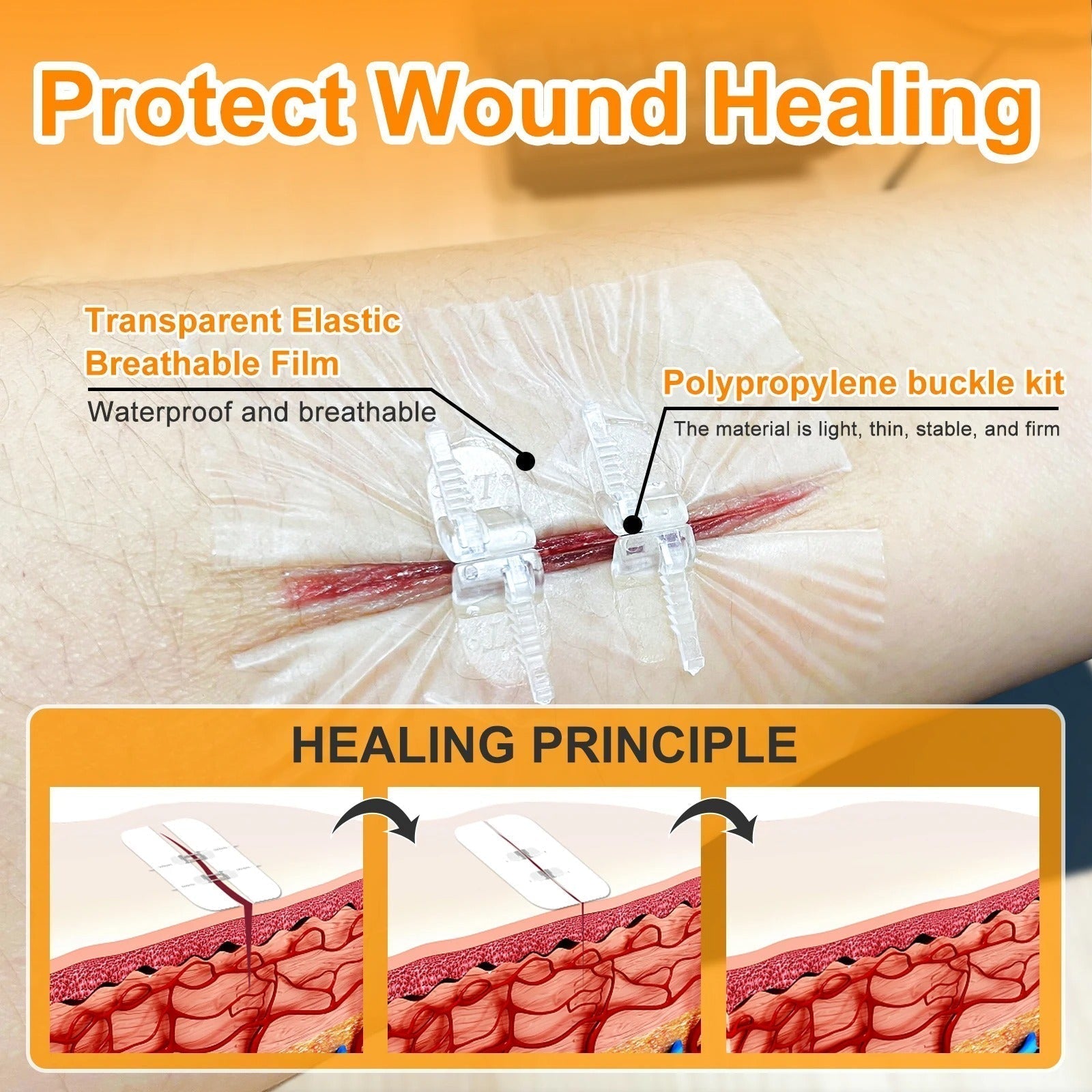 2PCS Advanced Wound Closure Kit 