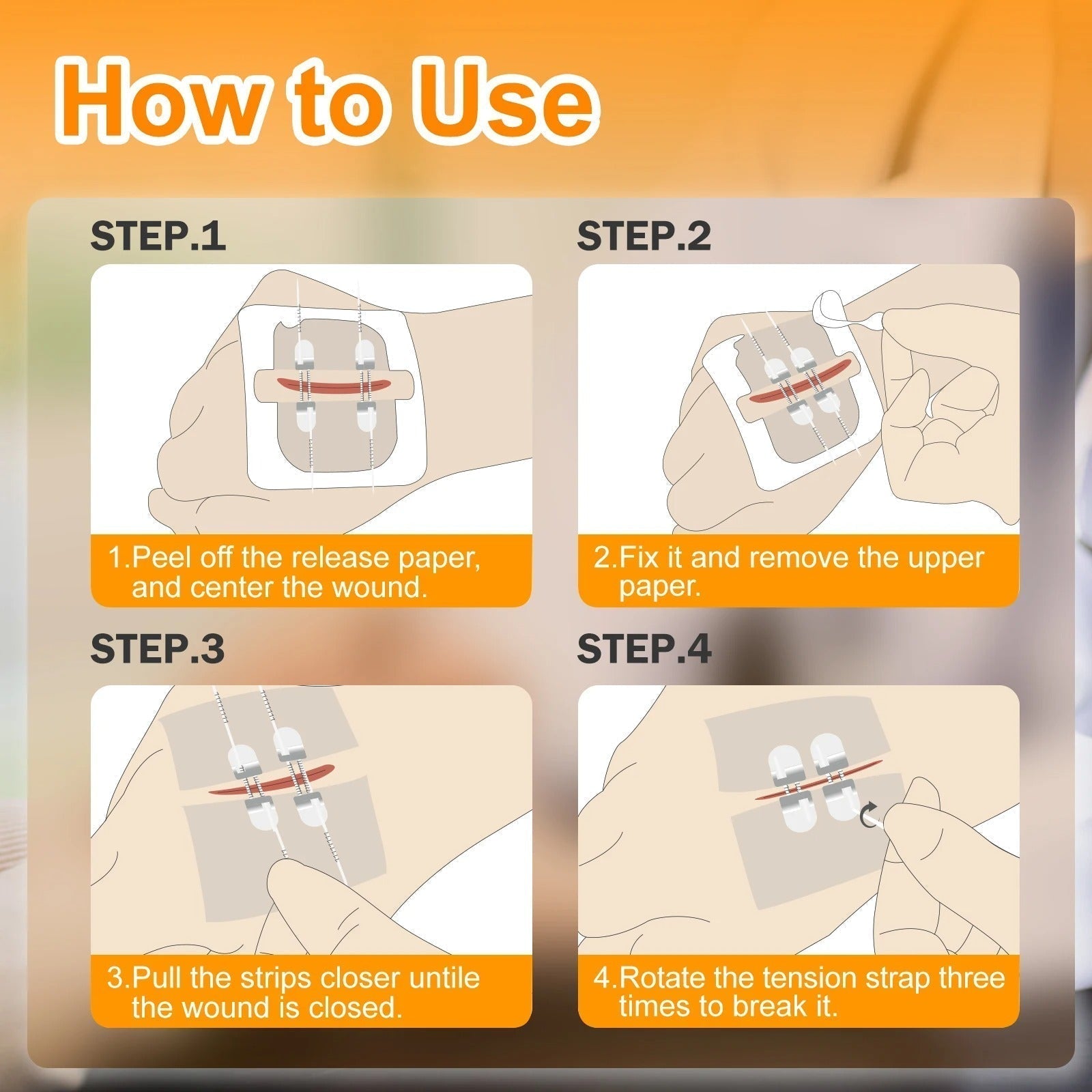 2PCS Advanced Wound Closure Kit 