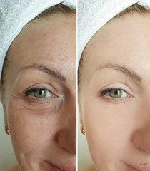 Anti-aging & wrinkle-removing eye cream 